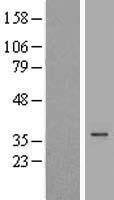 DHRS1 Human Over-expression Lysates NM_138452