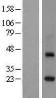 RAB3C Human Over-expression Lysates NM_138453