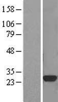 CTHRC1 Human Over-expression Lysates NM_138455