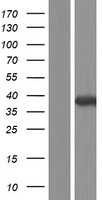 C16orf42 (TSR3) Human Over-expression Lysates NM_001001410