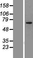 ls115948 ccdc151 human over expression lysates nm 145045 wb testing 1
