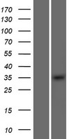 OSR2 Human Over-expression Lysates NM_001142462