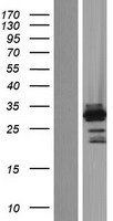 OSR2 Human Over-expression Lysates NM_053001