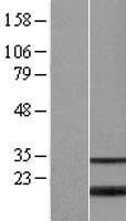 BATF2 Human Over-expression Lysates NM_138456