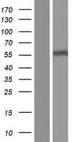 SLC22A12 Human Over-expression Lysates NM_144585
