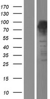 FOXP4 Human Over-expression Lysates NM_001012426
