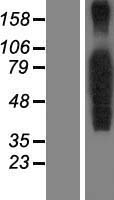 FOXP4 Human Over-expression Lysates NM_138457