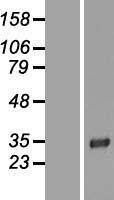LRP15 (LRRC3B) Human Over-expression Lysates NM_052953