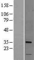 Nogo B receptor (NUS1) Human Over-expression Lysates NM_138459