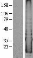 ls116159 cyyr1 human over expression lysates nm 052954 wb testing 1