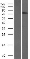 Transglutaminase 7 (TGM7) Human Over-expression Lysates NM_052955