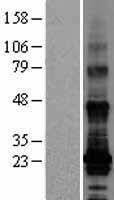 ls116211 tm4sf19 human over expression lysates nm 138461 wb testing 1