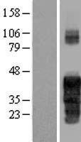 FAM122A Human Over-expression Lysates NM_138333