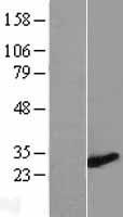 ZMYND19 Human Over-expression Lysates NM_138462