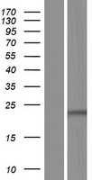 TLCD1 Human Over-expression Lysates NM_001160407