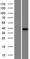 ls116255 mogt1 mogat1 human over expression lysates nm 058165 wb testing 1