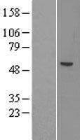 ls116285 acsm1 human over expression lysates nm 052956 wb testing 1