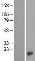 LYPD1 Human Over-expression Lysates NM_144586