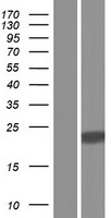 TM4SF18 Human Over-expression Lysates NM_001184723