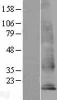 TM4SF18 Human Over-expression Lysates NM_138786