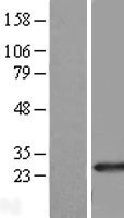RAB39B Human Over-expression Lysates NM_171998
