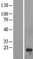 C1orf19 (TSEN15) Human Over-expression Lysates NM_052965
