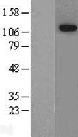 NIBAN1 Human Over-expression Lysates NM_052966