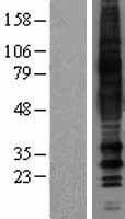 GPCR TGR7 (MRGPRD) Human Over-expression Lysates NM_198923