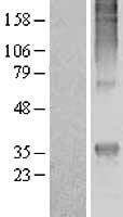 GPCR MRGE (MRGPRE) Human Over-expression Lysates NM_001039165