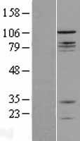 CNTROB Human Over-expression Lysates NM_053051