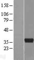 ls116969 art5 human over expression lysates nm 001079536 wb testing 1