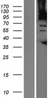 AGAP1 Human Over-expression Lysates NM_014914