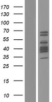 DACH2 Human Over-expression Lysates NM_001139514