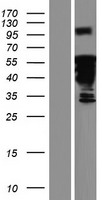 DACH2 Human Over-expression Lysates NM_001139515