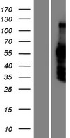 DACH2 Human Over-expression Lysates NM_053281