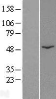 CATSPER2 Human Over-expression Lysates NM_054020