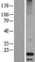 Dermcidin (DCD) Human Over-expression Lysates NM_053283