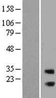 RAB3IP Human Over-expression Lysates NM_001024647