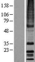 MRGX3 (MRGPRX3) Human Over-expression Lysates NM_054031