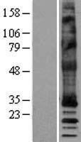 MRGPRX4 Human Over-expression Lysates NM_054032