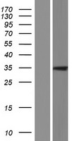 ls117245 plaat5 human over expression lysates nm 001146728 wb testing 2