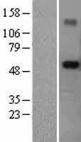 ls117854 rnf89 trim6 human over expression lysates nm 058166 wb testing 1