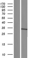 UBE2J2 Human Over-expression Lysates NM_194315