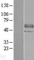 ANTXR2 Human Over-expression Lysates NM_058172