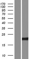 PRAP1 Human Over-expression Lysates NM_001145201