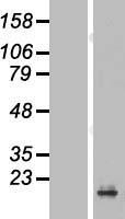 PRAP1 Human Over-expression Lysates NM_145202