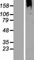 ls118663 btbd16 human over expression lysates nm 144587 wb testing 1