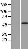 PSTK Human Over-expression Lysates NM_153336
