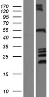 ZFYVE27 Human Over-expression Lysates NM_001002261