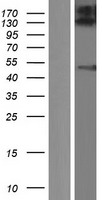 ZFYVE27 Human Over-expression Lysates NM_001002262